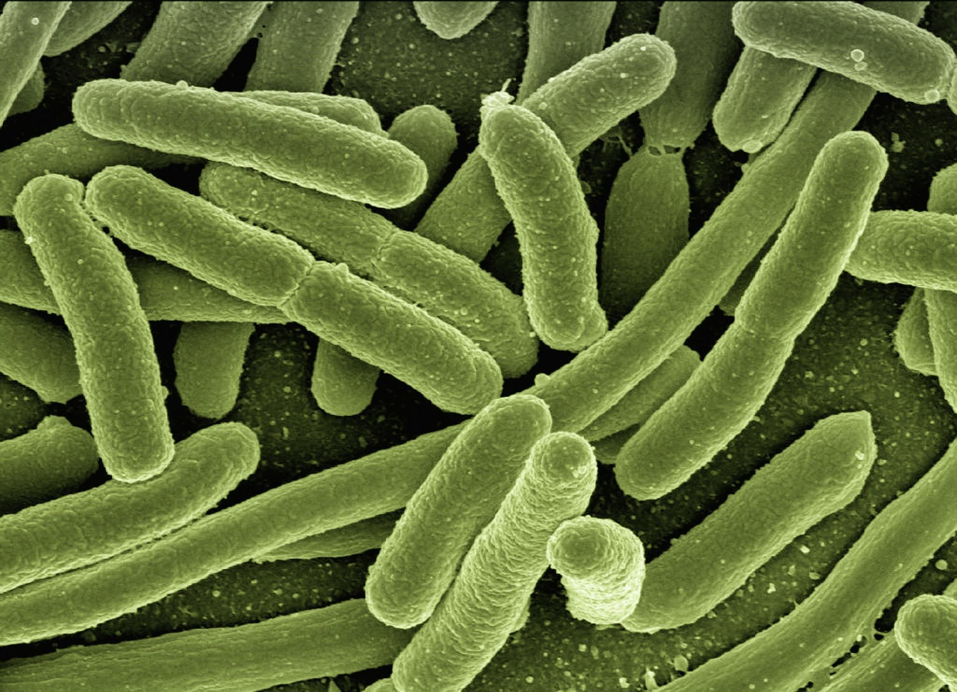 Photo of Escherichia coli 